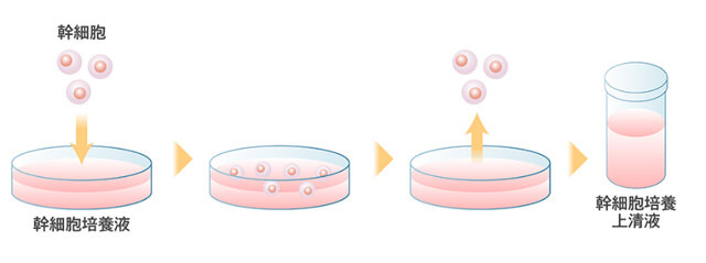 幹細胞治療と幹細胞上清療法の違いについて